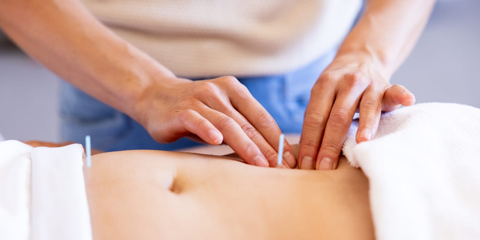 A practitioner's hands placing fine acupuncture needles along a pregnant patient's abdomen during a prenatal treatment session.